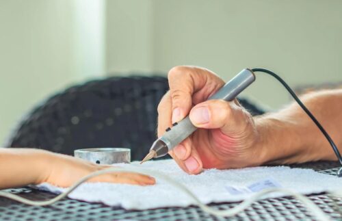 اسکن بدن با دستگاه بیورزونانس